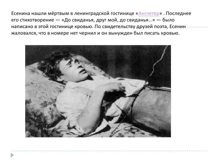 Есенин Последнее Фото Есенин Последнее Фото